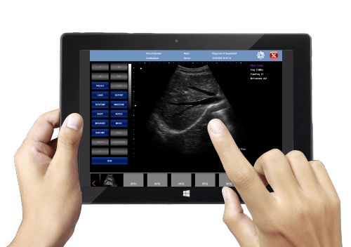 V10 Tablet PC based Ultrasound B Scanner
